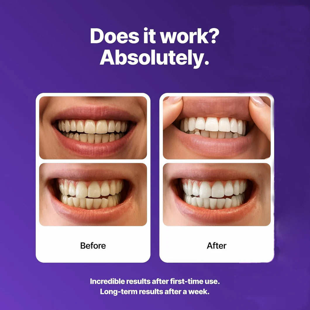 Smilify® Whitening Strips